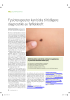 Fysioterapeuter kan bidra til tidligere diagnostikk av føflekkreft