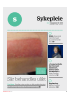 Sår behandles ulikt
