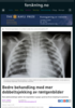 Bedre behandling med mer dobbeltsjekking av røntgenbilder
