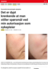 Kosmetisk dermatologisk sykepleie: Det er dypt krenkende at man stiller spørsmål ved min autorisasjon som sykepleier